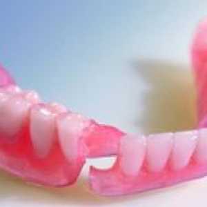 Ako si vybrať zubné nylonové zubné protézy?