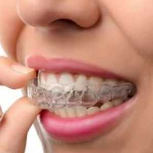 Ako zladiť zuby bez podložiek: efektívne metódy