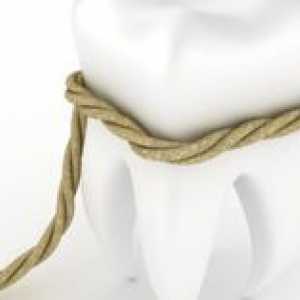 Čo môžu byť komplikácie po extrakcii zubov?