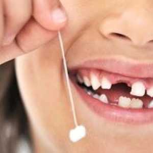Aké detské zuby sa v dieťati menia na trvalé