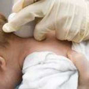 Cyst v hlave u novorodencov: príčiny a dôsledky