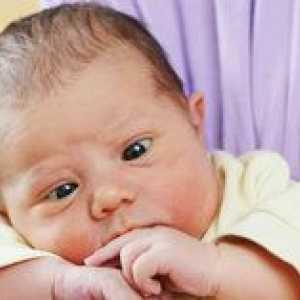 Kedy sa má u novorodencov vyskytnúť strabizmus