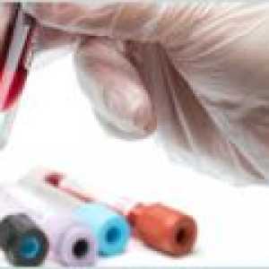 Kvantitatívny test na tuberkulózu in vitro