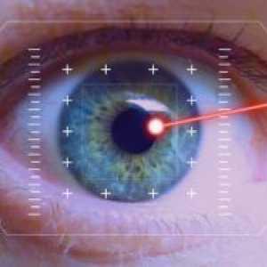 Korekcia zraku laserom: následky a recenzie