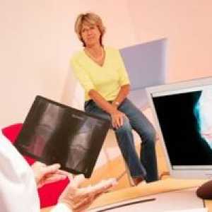 Liečba menisku kolenného kĺbu: príznaky a príčiny ochorenia