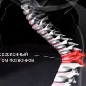 Liečba starších ľudí s kompresnou zlomeninou chrbtice