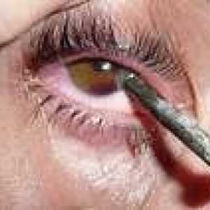 Liečba doma s traumou očí