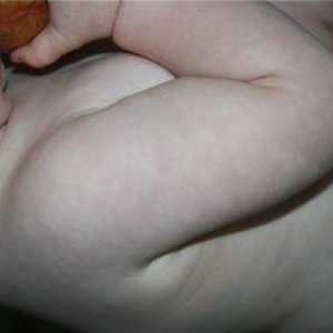 Mramorová koža u dojčiat: príčiny a spôsoby liečby