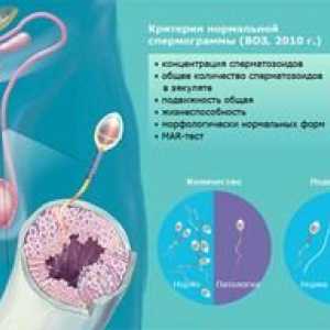 Normy pre analýzu spermogramu u mužov a príčiny abnormalít