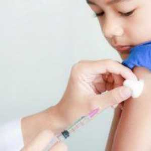 Potrebujete očkovanie proti ovčím kiahňam pre dospelých a deti?