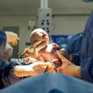 Hlavné obdobia pôrodu a ich trvanie