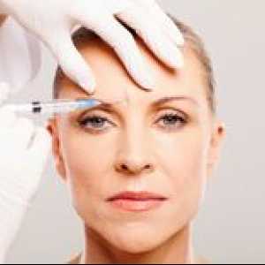 Funkcie a princíp fungovania Botoxu