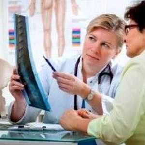 Osteoporóza u žien po 50 rokoch: príznaky a liečba