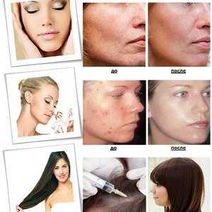 Ozónová terapia tváre v kozmeteológii