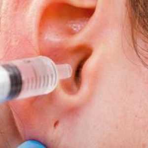 Peroxid vodíka pre uši: samočistiť síru v uchu