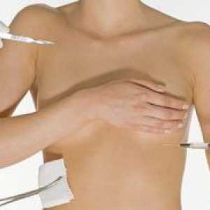 Plastická operácia prsníkov: hlavné typy operácií a koľko stojí