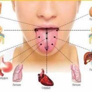 Prečo bolí jazyk: príčiny problému a spôsoby liečby