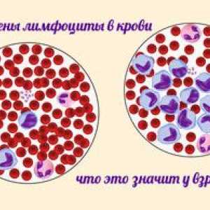 Prečo sa môžu zvýšiť lymfocyty u dieťaťa?