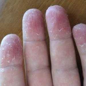Prečo koža na prstoch