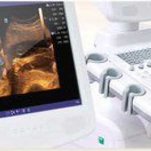Príprava na štúdium prostaty (ultrazvuk)