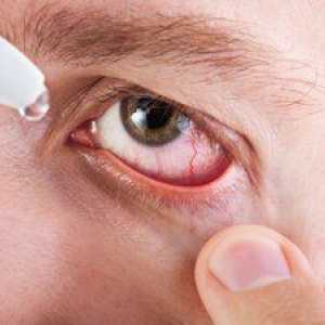 Sčervenanie očí a zápal: príčiny a symptómy, liečba