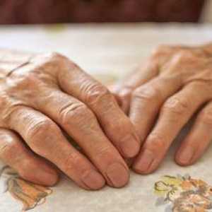 Polyartritída prstov: liečba tradičnými a ľudovými prostriedkami