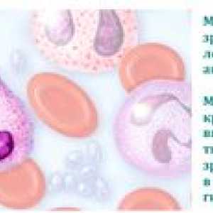 Zvýšený počet monocytov v krvi