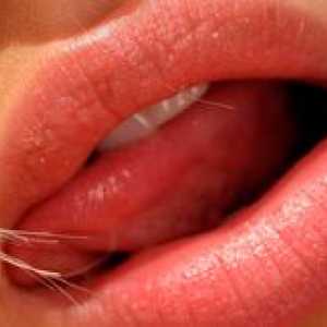 Akné a pupienky v jazyku - čo robiť