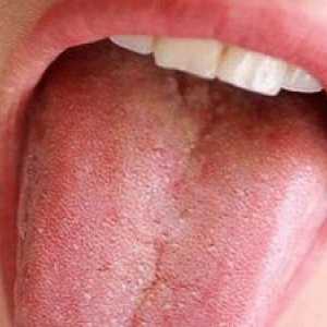Pichliaky na jazyku sú bližšie k hrtanu: červené pupienky
