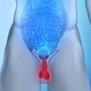 Rakovina prostaty u mužov: príznaky, liečba prostaty