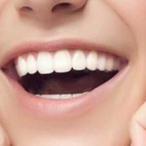 Remineralizácia zubov doma: indikácie
