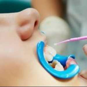 Strieboranie zubov u detí: pre a proti