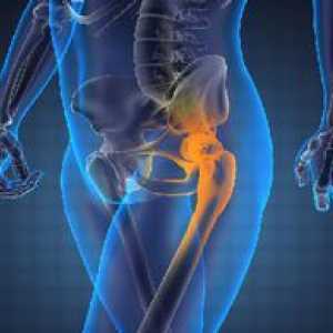 Symptómy ochorenia bedrového kĺbu a jeho liečba