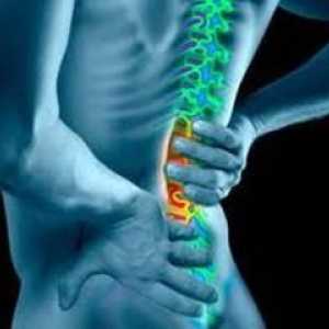 Príznaky a liečba ochorení a ochorení chrbtice