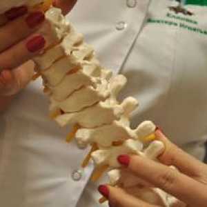 Skolióza chrbtice u dospelých: príznaky a liečba