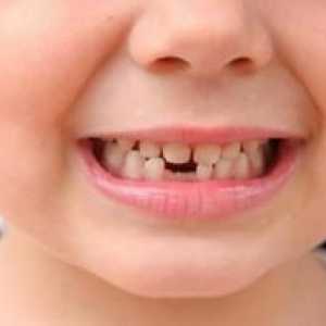 Koľko detských zubov majú deti?