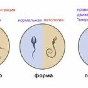 Spermogramma pre mužov: ako urobiť spermogram