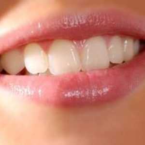 Metódy na rýchle bielenie zubov: odporúčania a upozornenia