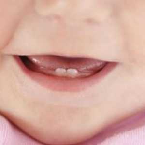 Podmienky pre erupciu trvalých zubov: načasovanie erupcie mliečnych zubov