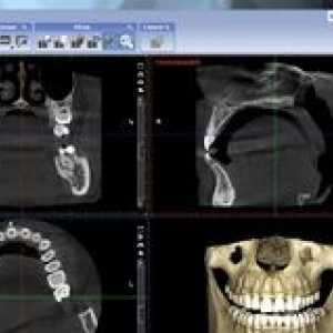 Trg v laterálnej projekcii lebky, aplikácia v zubnom lekárstve