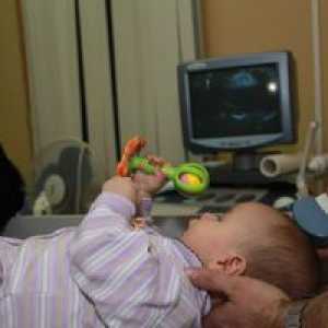 Ultrazvuk mozgu u novorodencov