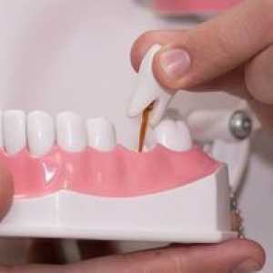 Možnosti výmeny zubov: náhrada zubov pre protetiku