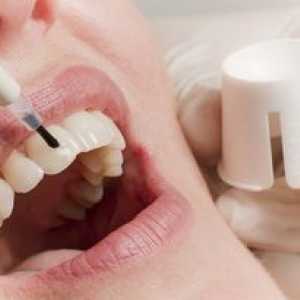 Obnova zubnej skloviny: metódy obnovy zubnej skloviny