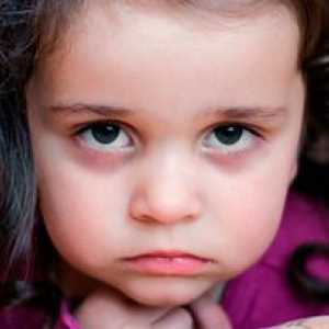 Vzhľad tmavých kruhov pod očami detí: príčiny
