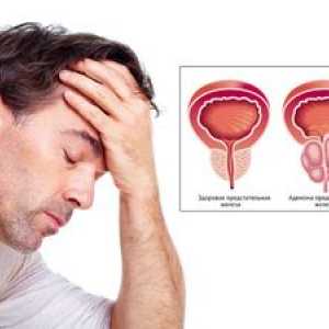Choroby prostaty: príznaky
