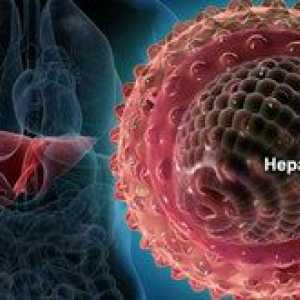 Je žltačka vírusom akého druhu hepatitídy?