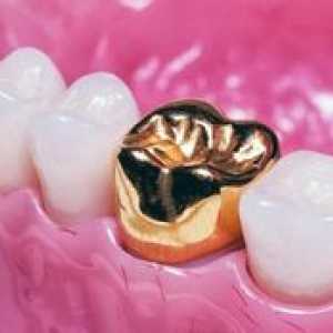 Zlaté zuby - kvalitná stomatológia alebo mauvetón?
