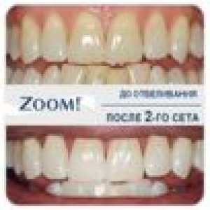 Zoom 4 - nové a bezpečné zuby na bielenie